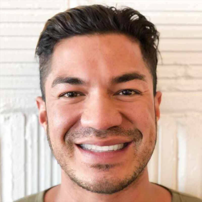 After Invisalign