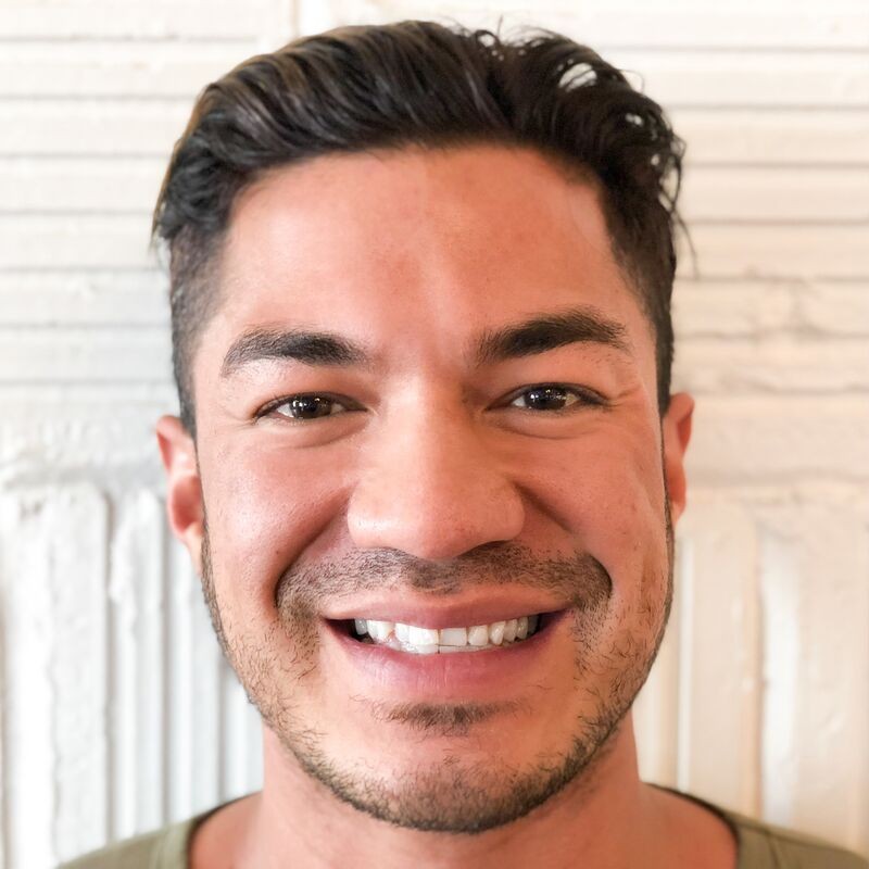 Before Invisalign